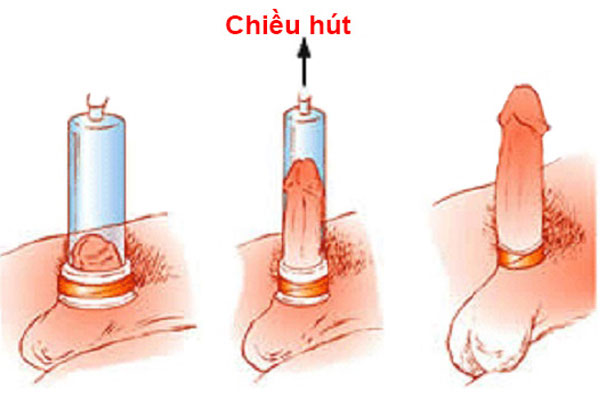 Máy tập dương vật sử dụng áp lực để tăng kích thước dương vật